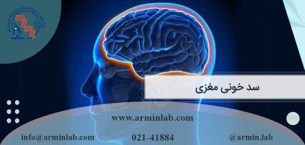 سد خونی مغزی