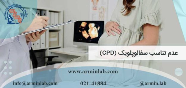 عدم تناسب سفالوپلویک