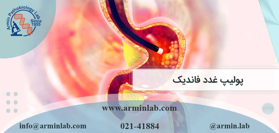 پولیپ غدد فاندیک