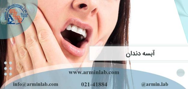 آبسه دندان