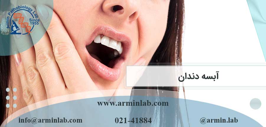 آبسه دندان