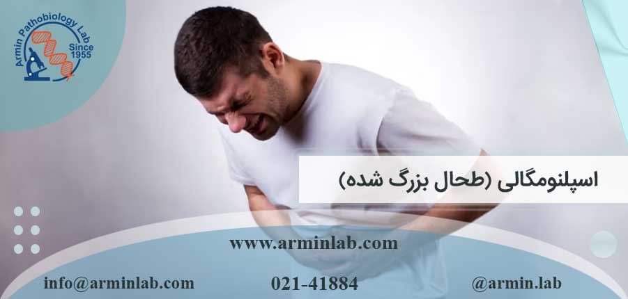 اسپلنومگالی (طحال بزرگ شده)