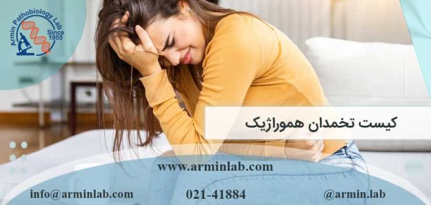 کیست تخمدان هموراژیک