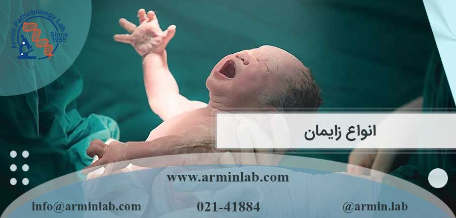 انواع زایمان