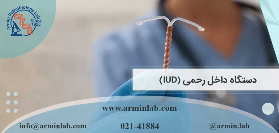 دستگاه داخل رحمی (IUD)