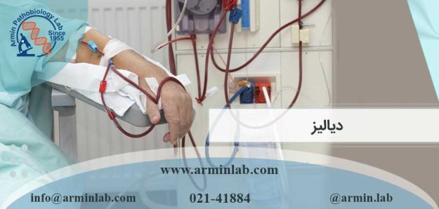 دیالیز