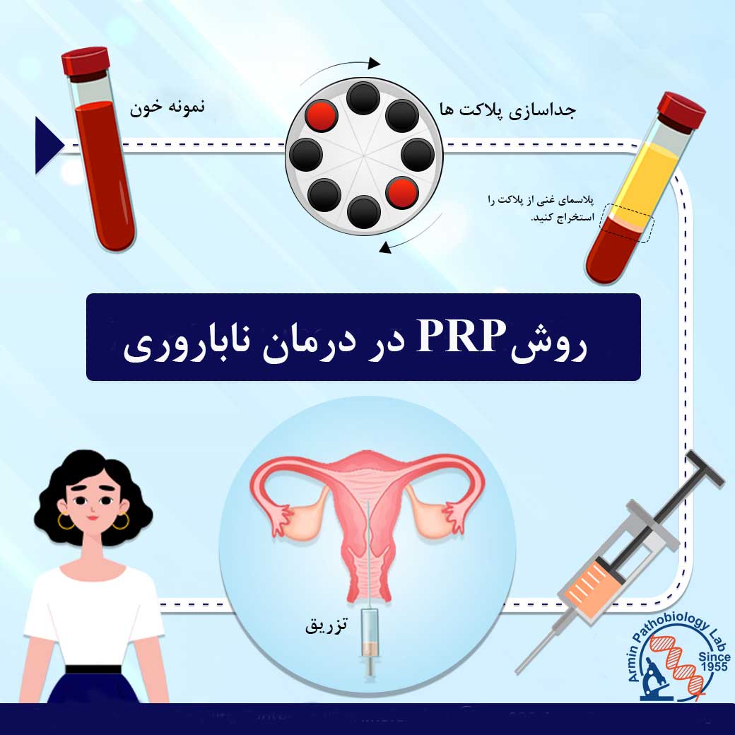 روش PRP در درمان ناباروری و IVF