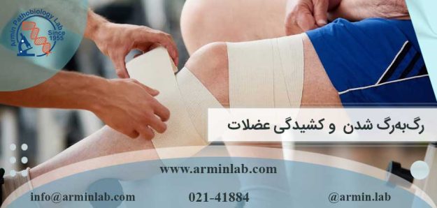 رگ ‌به‌رگ شدن و کشیدگی عضلات