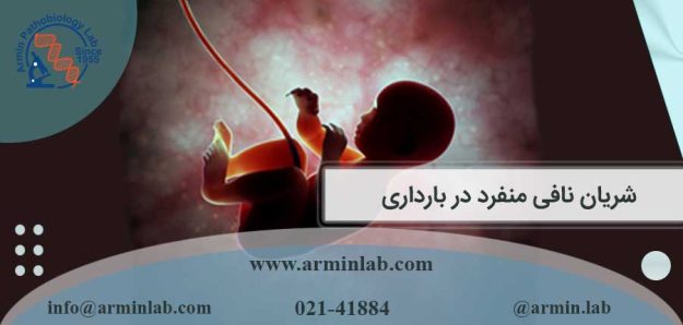 شریان نافی منفرد در بارداری