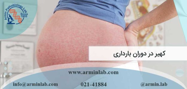 کهیر در دوران بارداری