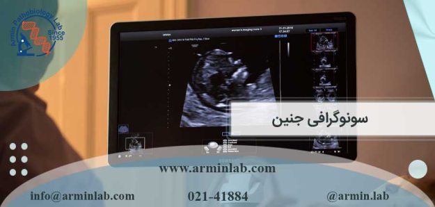 سونوگرافی جنین