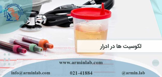 لکوسیت ها در ادرار