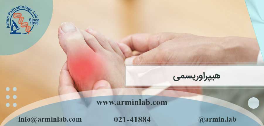 هیپراوریسمی