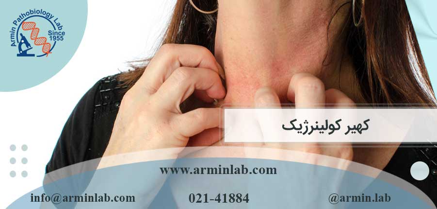 کهیر کولینرژیک