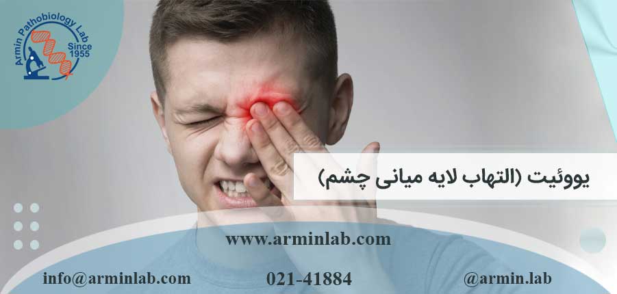 یووئیت (التهاب لایه میانی چشم)