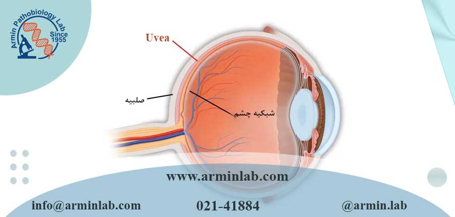 یووئیت (التهاب لایه میانی چشم)