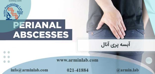 آبسه پری آنال