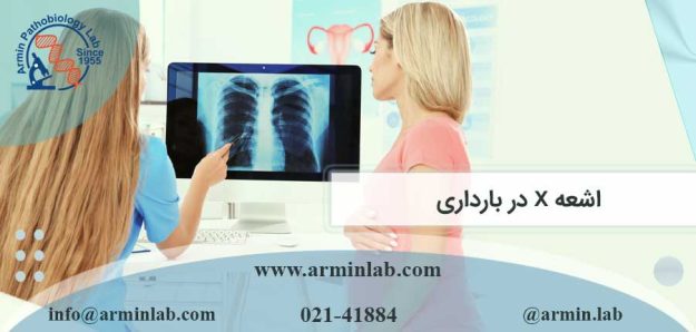 اشعه X در بارداری