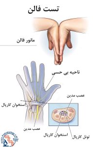 تست فالن چیست؟