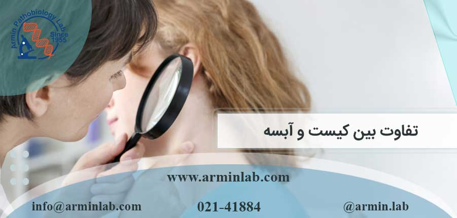 تفاوت بین کیست و آبسه