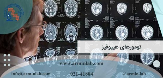 تومورهای هیپوفیز