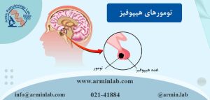 تومورهای هیپوفیز