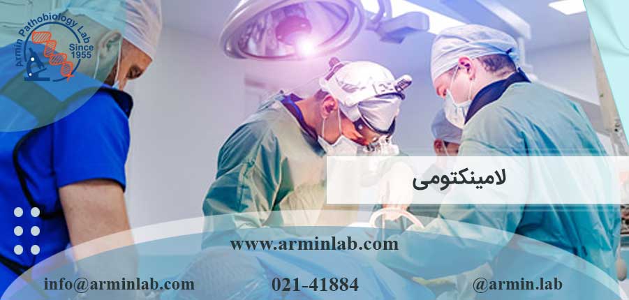 لامینکتومی