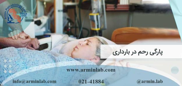 پارگی رحم در بارداری