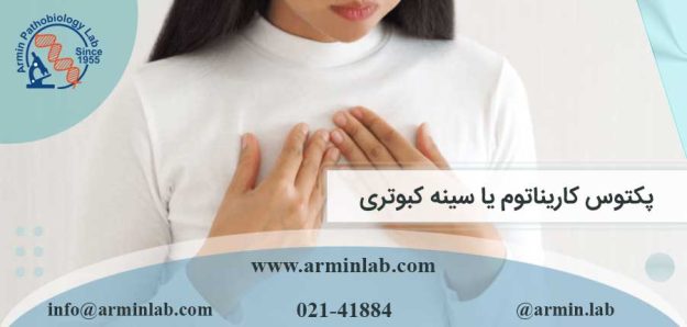 پکتوس کاریناتوم یا سینه کبوتری