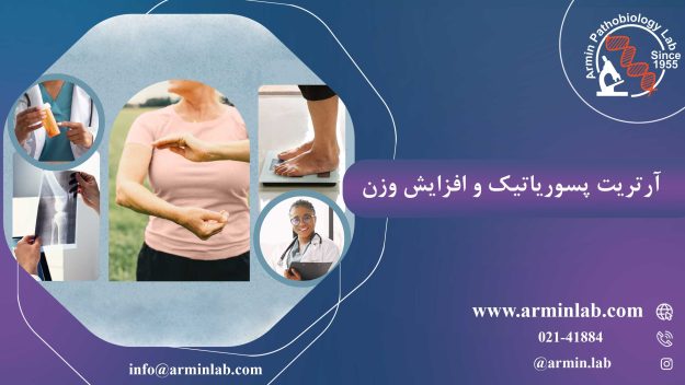 آرتریت پسوریاتیک و افزایش وزن