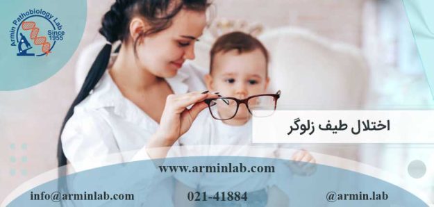 اختلال طیف زلوگر