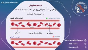 ترومبوسیتوپنی در بارداری  