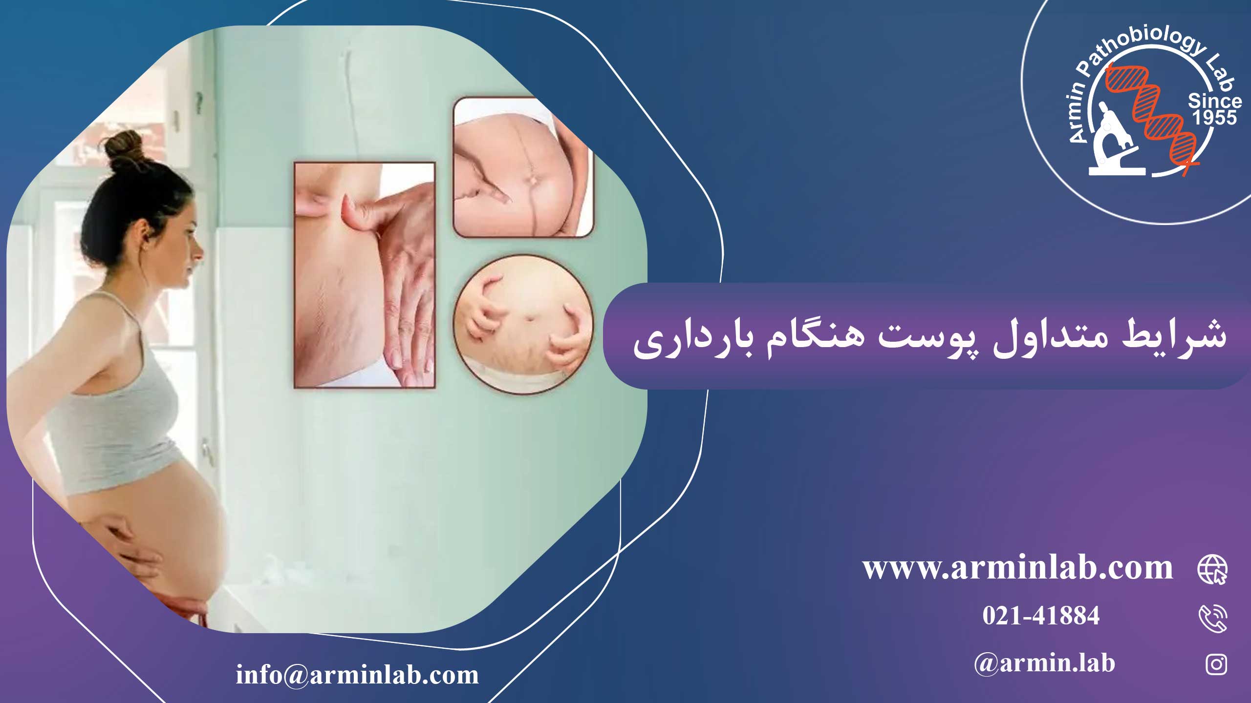 شرایط متداول پوست هنگام بارداری