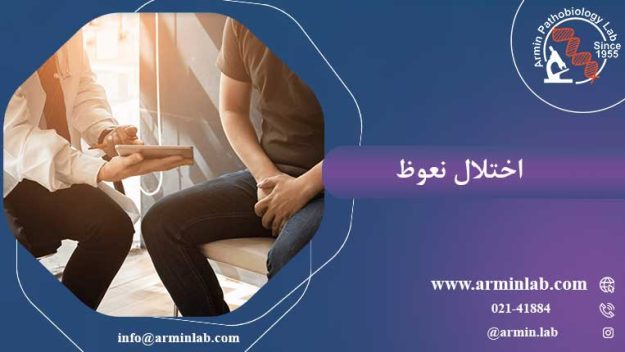 اختلال نعوظ