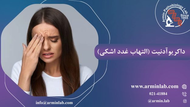 arminlabداکریوآدنیت-(التهاب-غدد-اشکی) داکریوآدنیت (التهاب غدد اشکی)