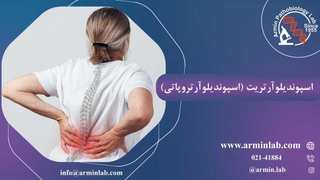 اسپوندیلوآرتریت (اسپوندیلوآرتروپاتی)