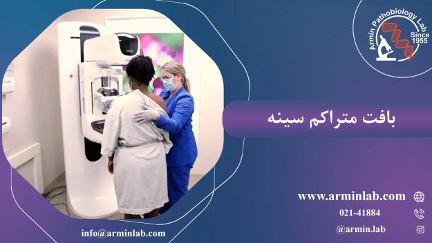 بافت متراکم سینه