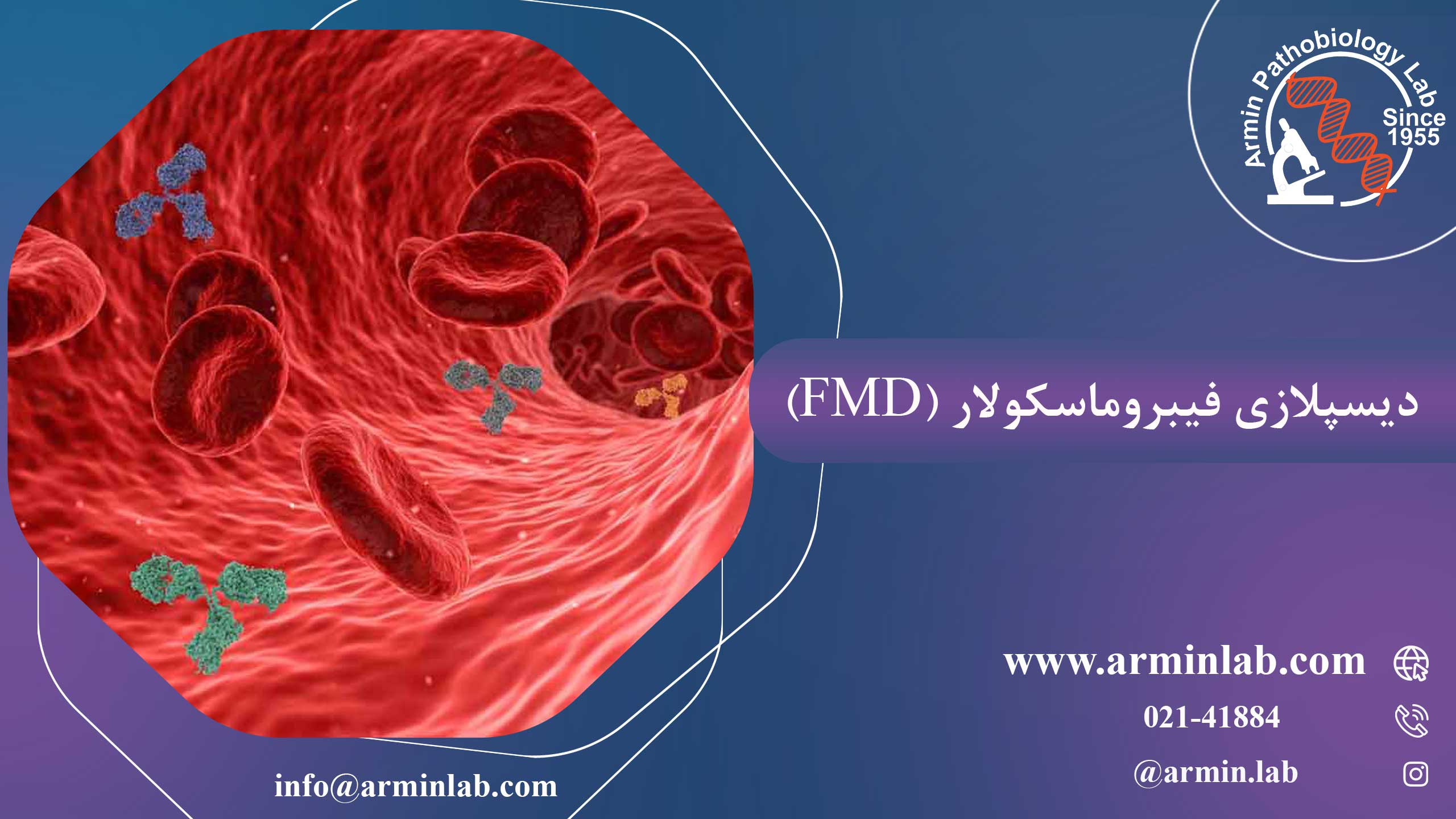 دیسپلازی فیبروماسکولار (FMD)