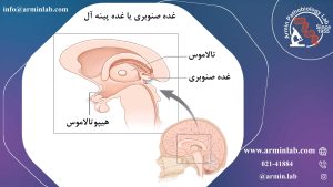 غده صنوبری یا غده پینه آل