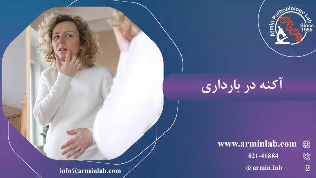آکنه در بارداری