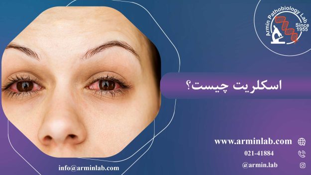 اسکلریت چیست؟