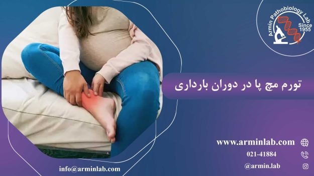 تورم مچ پا در دوران بارداری