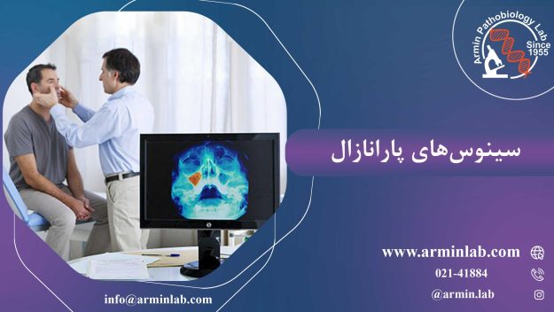 سینوس های پارانازال