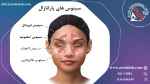 سینوس های پارانازال