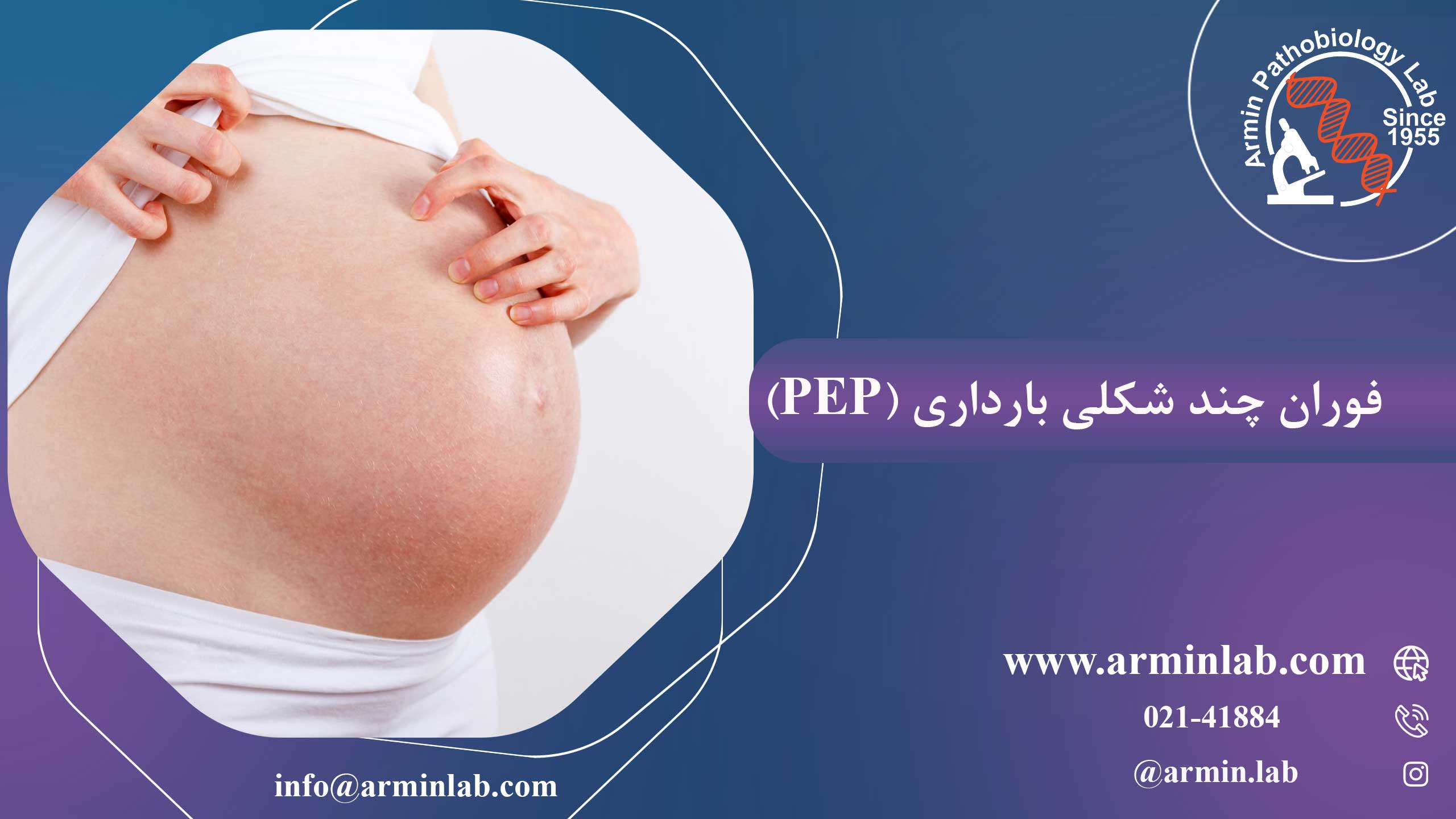 فوران چند شکلی بارداری (PEP)