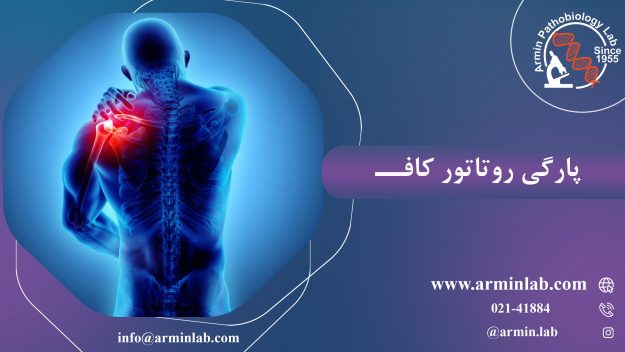 پارگی روتاتور کاف