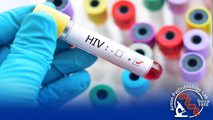 کمک به جلوگیری از انتقال HIV به کودک