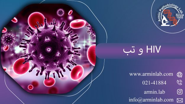 HIV و تب