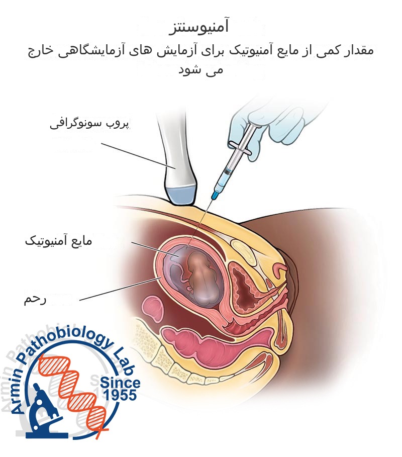 آمنیوسنتز | آزمایشگاه آرمین