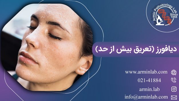 علائم دیافورز (تعریق بیش از حد) چیست؟ | آزمایشگاه آرمین